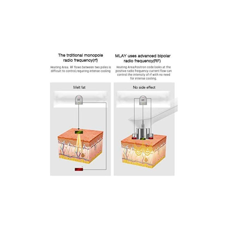 MLAY RF Skin Tightening Device: Professional Anti-Aging for Face & Body - Wrinkle Reduction & Lifting at Home MLAY RF Skin Tightening Device: Professional Anti-Aging for Face & Body - Wrinkle Reduction & Lifting at Home