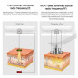 MLAY RF Skin Tightening Device: Professional Anti-Aging for Face & Body - Wrinkle Reduction & Lifting at Home MLAY RF Skin Tightening Device: Professional Anti-Aging for Face & Body - Wrinkle Reduction & Lifting at Home