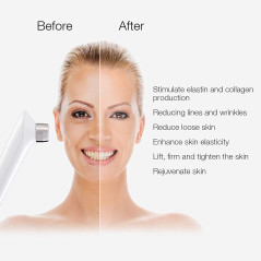 MLAY RF, the device that tightens the skin