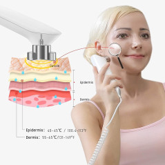 MLAY RF, l'appareil qui resserre la peau