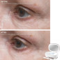 Trophy Skin UltradermMD: At-Home Microdermabrasion for Radiant, Youthful Skin Trophy Skin UltradermMD: At-Home Microdermabrasion for Radiant, Youthful Skin