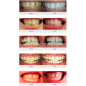 AuraGlow Radiant Smile Teeth Whitening Kit: Get a Brighter Smile at Home! AuraGlow Radiant Smile Teeth Whitening Kit: Get a Brighter Smile at Home!
