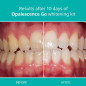 Opalescence Go 10 Menthe: Blanchiment Facile et Rapide pour un Sourire Éclatant! Opalescence Go 10 Menthe: Blanchiment Facile et Rapide pour un Sourire Éclatant!