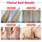 Imene T4: Épilateur à Lumière Pulsée (IPL) - Épilation Définitive, Douce et Efficace à Domicile! Imene T4: Épilateur à Lumière Pulsée (IPL) - Épilation Définitive, Douce et Efficace à Domicile!