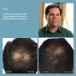 HairMax Laser Comb: FDA-Cleared Hair Growth Treatment - Regrow Thicker, Fuller Hair! HairMax Laser Comb: FDA-Cleared Hair Growth Treatment - Regrow Thicker, Fuller Hair!