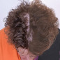 Capillus82: Casque Laser Anti-Chute, Repousse Efficace des Cheveux - Technologie FDA Capillus82: Casque Laser Anti-Chute, Repousse Efficace des Cheveux - Technologie FDA