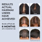 HairMax RegrowMD Laser Cap: FDA-Cleared Hair Growth Treatment - See Results in Months!