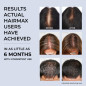 HairMax LaserBand 82: Regrow Thicker Hair in Just 90 Seconds! HairMax LaserBand 82: Regrow Thicker Hair in Just 90 Seconds!