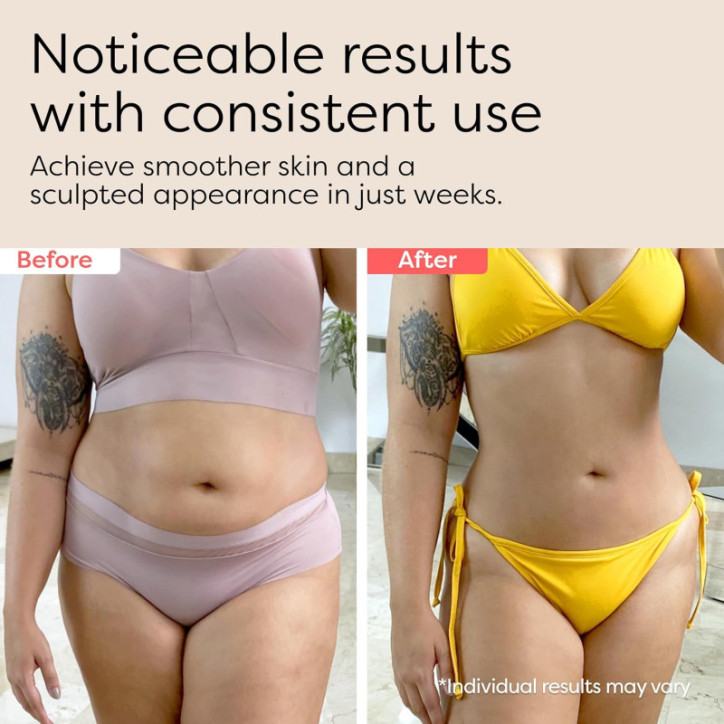 ReduSculpt: Sculpteur Corporel 3-en-1 - Anti-Cellulite, Raffermissement & Drainage Lymphatique ReduSculpt: Sculpteur Corporel 3-en-1 - Anti-Cellulite, Raffermissement & Drainage Lymphatique