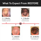 iRestore Essential : Casque Laser Anti-Chute de Cheveux - Croissance Prouvée, Résultats Visibles! iRestore Essential : Casque Laser Anti-Chute de Cheveux - Croissance Prouvée, Résultats Visibles!