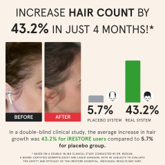 iRestore Essential Laser Cap — FDA-cleared solution for hair growth, thinning & alopecia in men & women!
