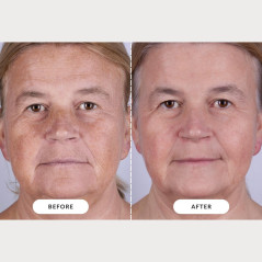 CurrentBody Skin LED Light Therapy Mask Series 2 – Advanced Skincare Tech