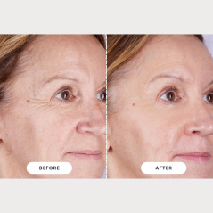 Masque LED CurrentBody Skin Thérapie Série 2 – Efficacité Pro