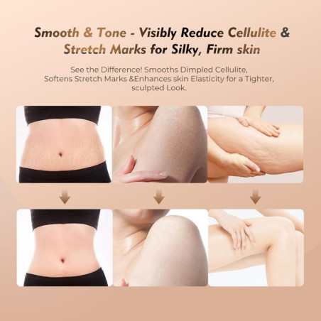 35-Speed 3-in-1 Lymphatic Drainage Massager with Microcurrent, Heat & Vibration – Anti-Cellulite Body Sculpting Tool (White)