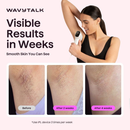 Wavytalk IPL Hair Removal Device – Painless Full Body, Long-Lasting Results