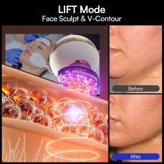 INIA SPHERA 8-in-1 Microcurrent Facial Device with Red Light & Cooling