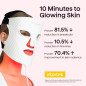 wavytalk Red Light Therapy Face Mask with LED for Anti-Aging, Acne & Skin Rejuvenation - White