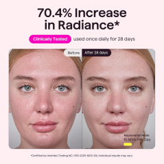 wavytalk Red Light Therapy Mask for Face – Anti-Aging & Acne Care