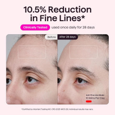 wavytalk Red Light Therapy Mask for Face – Anti-Aging & Acne Care