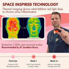 Original NoMore Red Light Therapy Nose Device – Sinus Relief & Dry Nose