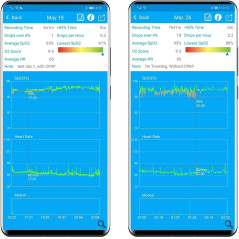 Lookee Sleep-Ring Oxygen Tracker, take care of your sleep